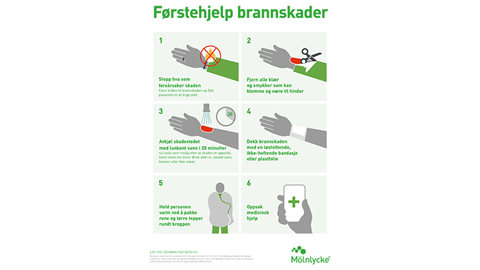 Burns first aid infographic